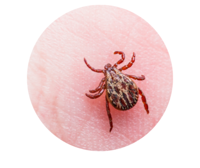 Tick on hand