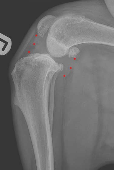 Radiograph of Stifle Pre Op